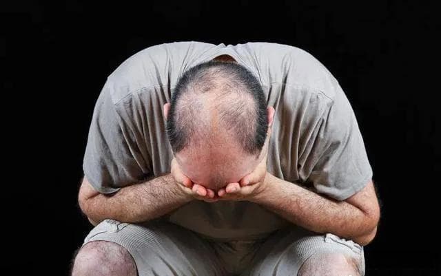 脱发严重该如何挽救？医生：分享6个小妙招，预防脱发很管用！