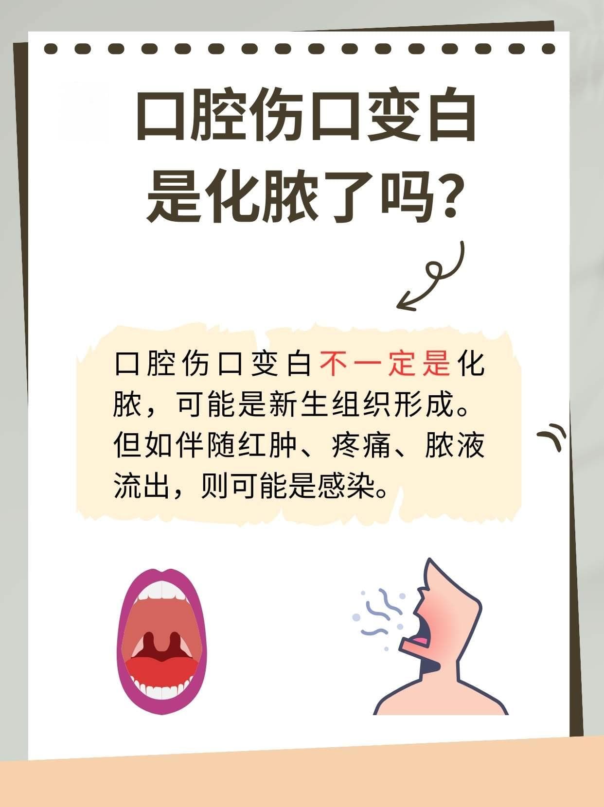 口腔伤口变白，是化脓了吗？
