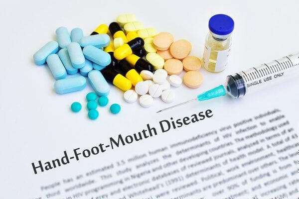 手足口病的主要症状是什么?怎样预防?
