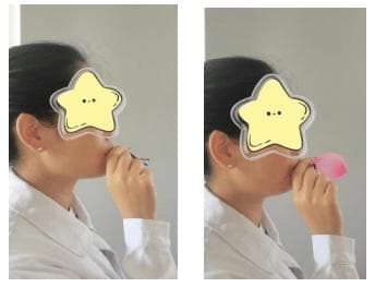 气切患者说话的桥梁——说话瓣膜