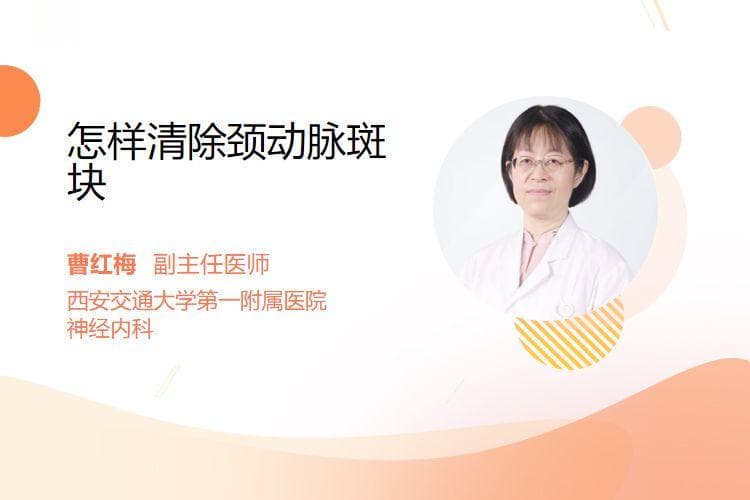 怎样清除颈动脉斑块