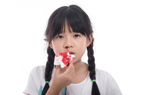 经常流鼻血缺什么维生素