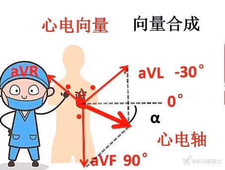 心电图原理：从心电向量到三维心电向量环