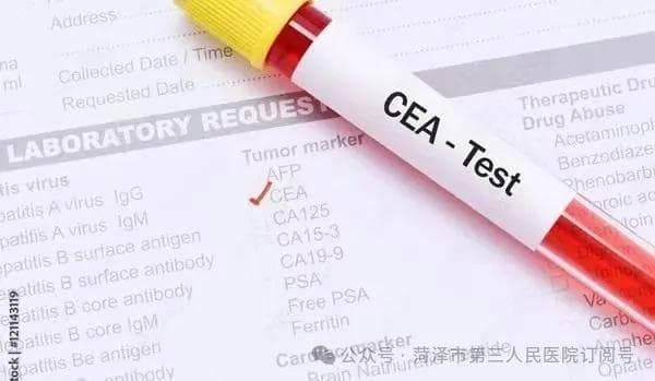 癌胚抗原（CEA）升高就是癌症？专家解读体检报告中的"显眼包"