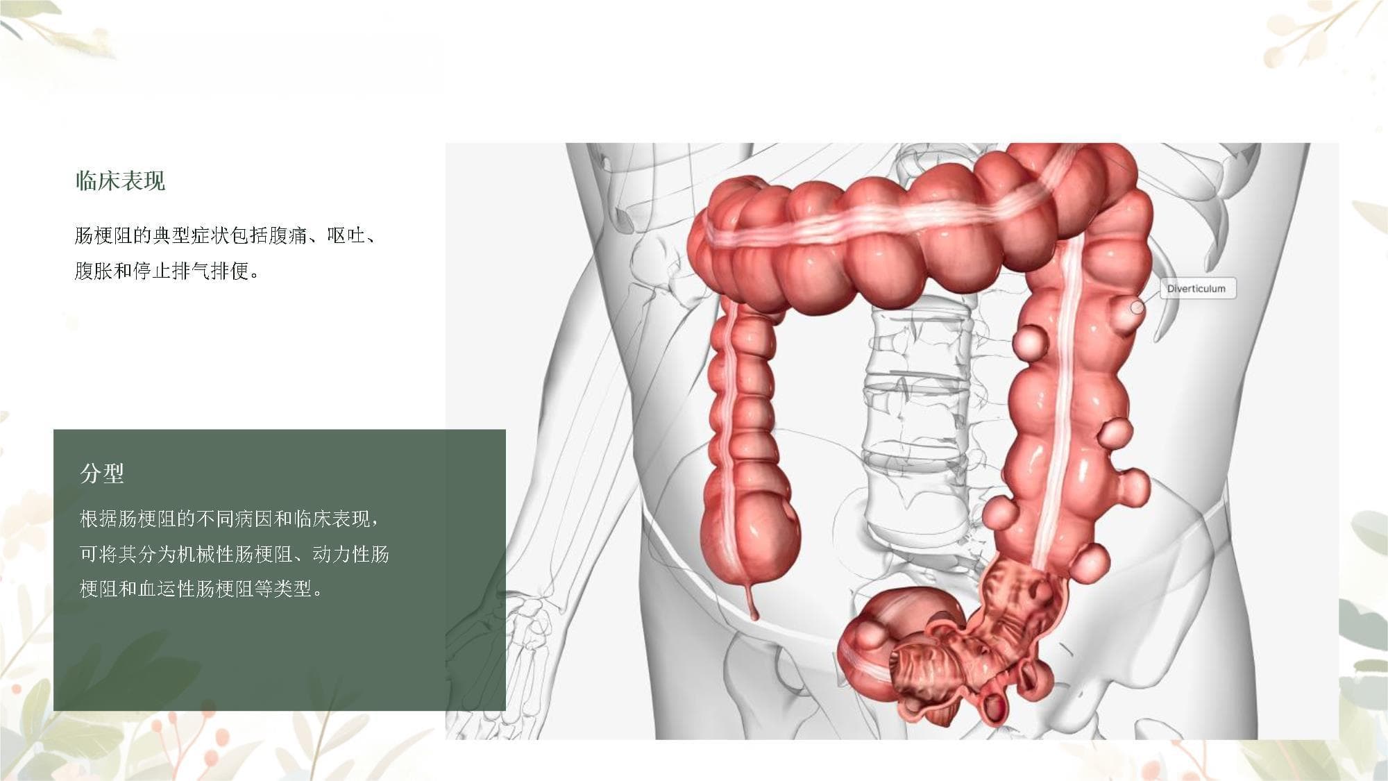 肠梗阻心理护理方法