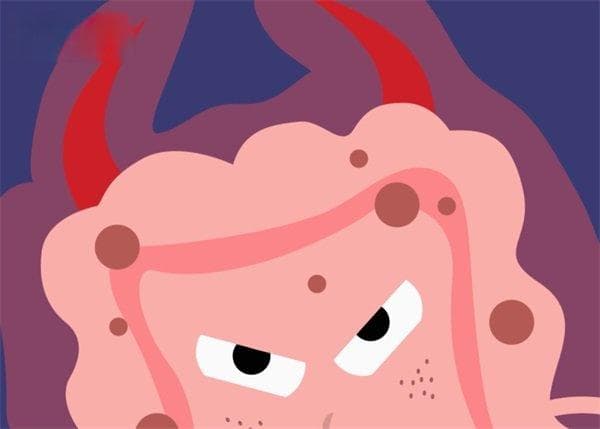 小脑淋巴瘤：病因、症状、诊断与治疗全解析