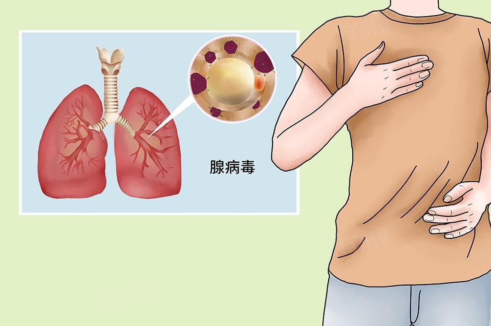 腺病毒感染血常规表现