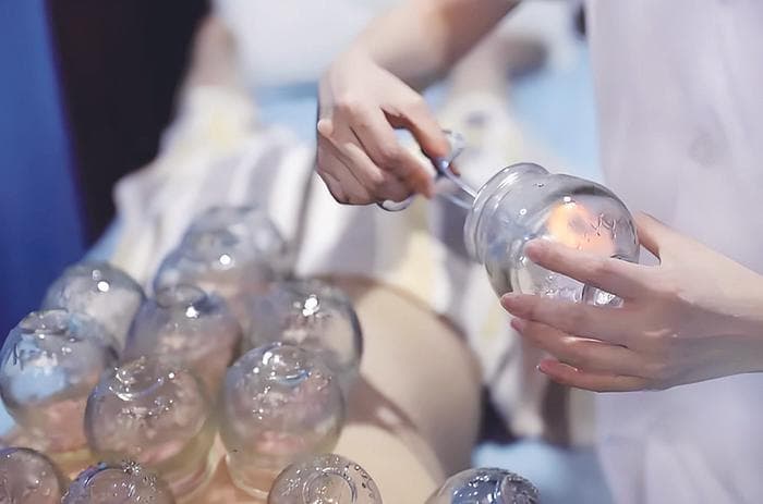 对于“神秘东方力量”的拔罐 这些说法都不正确