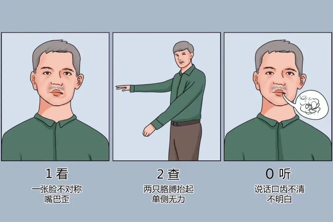 中风发作前，身体出现“3不能”，千万别错过黄金抢救期！