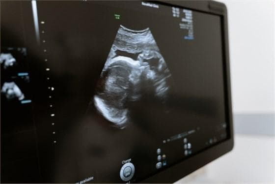 孕妇超声科检查重点关注哪些胎儿发育指标？