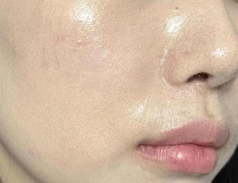 混油皮适合用散粉还是定妆喷雾？
