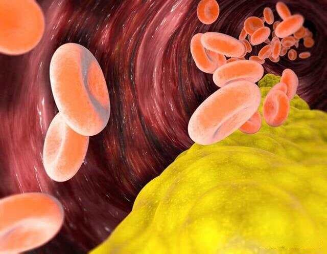 胆固醇偏高可以吃鸡蛋黄吗？提醒：不想血脂超标，4种食物要少碰