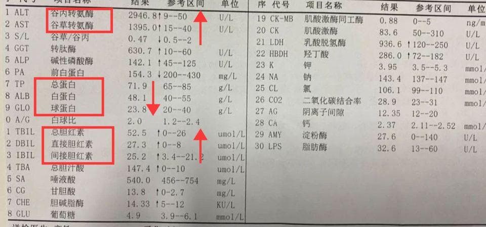 一分钟带你看懂肝功能化验单
