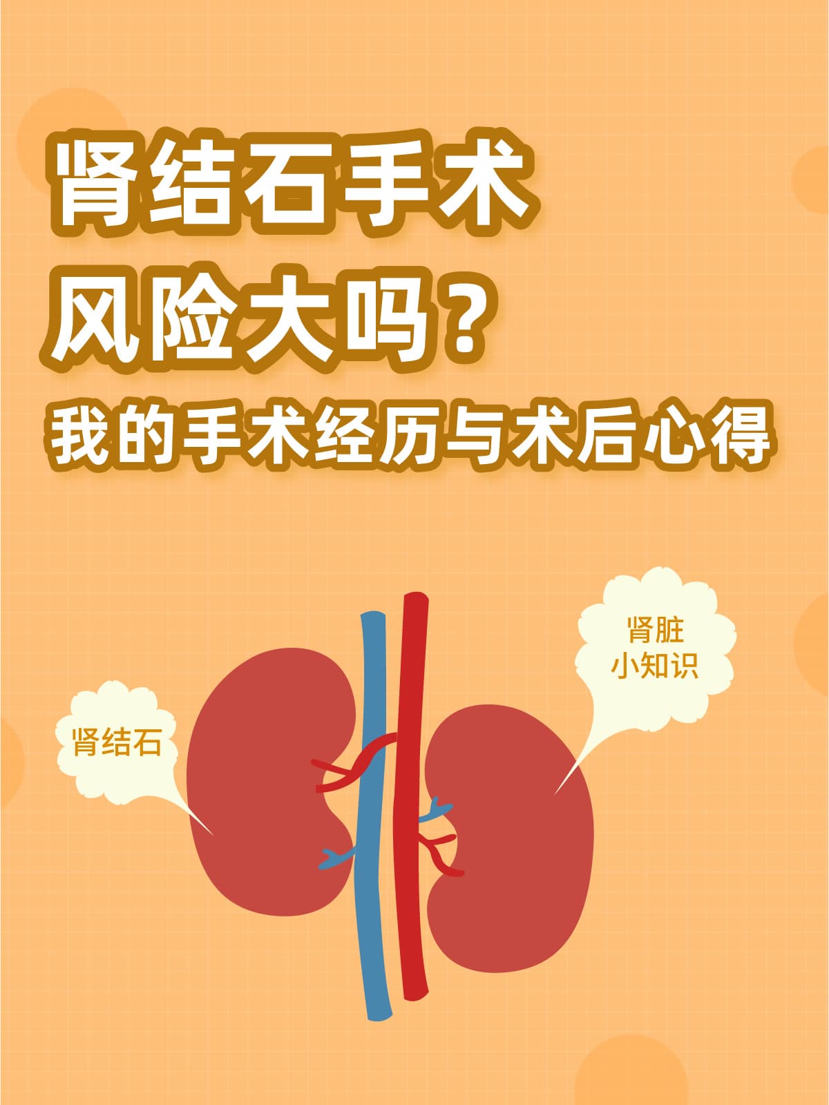 肾结石手术风险大吗？一位患者的手术经历与术后心得
