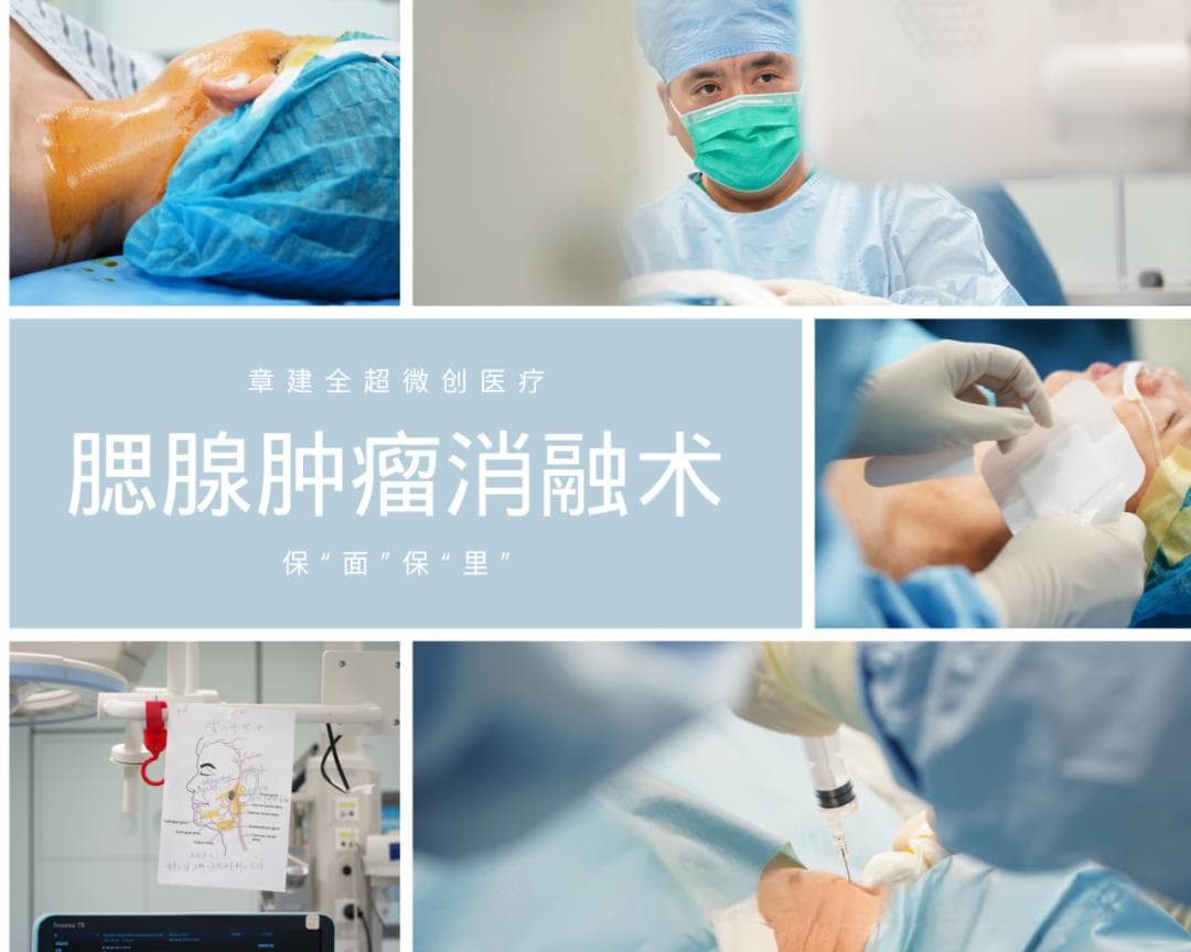 腮腺肿瘤——不可小觑的病