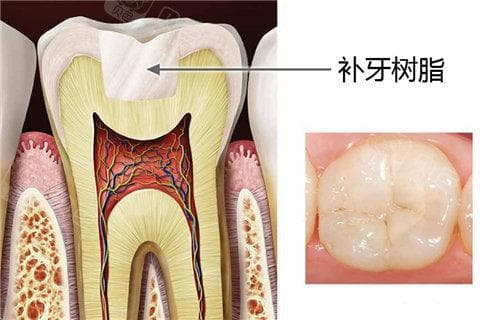 牙疼的实在受不了怎么办？教你缓解牙疼的小妙招~但及时治疗依然是根本！