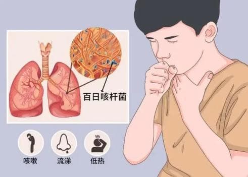 开学健康守护！这些秋季常见传染病预防知识，请收好
