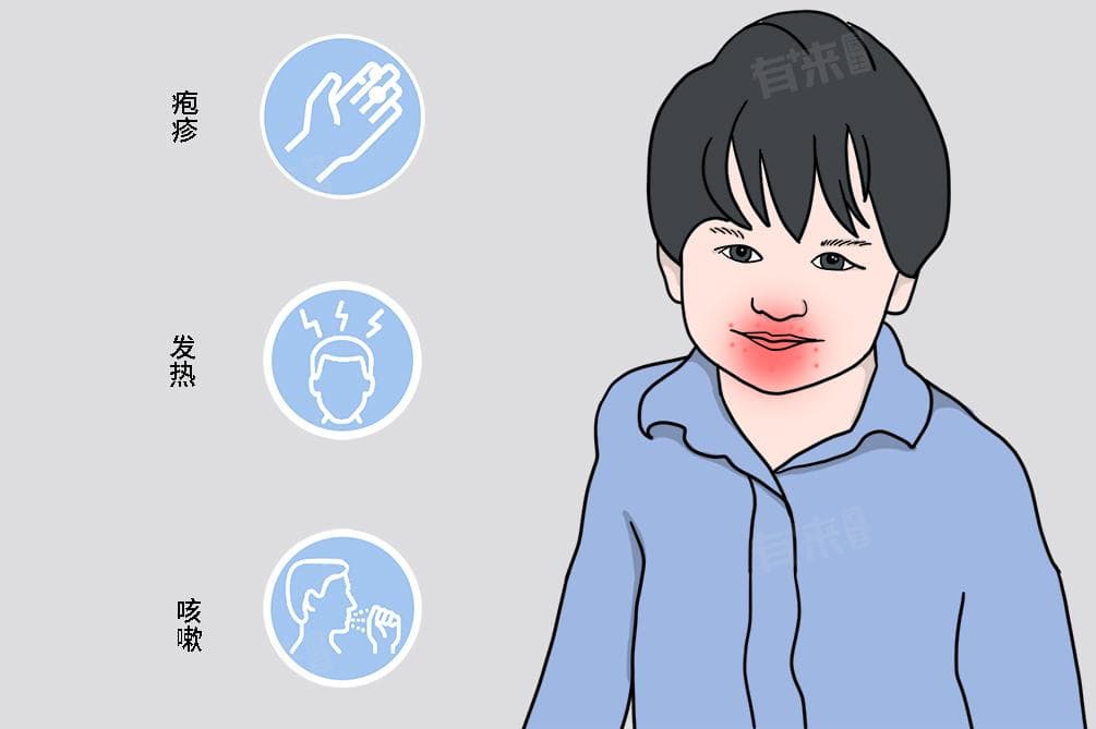 手足口病特别痒正常吗