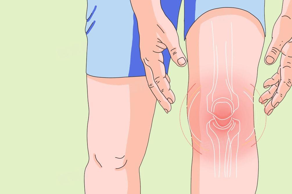 滑膜炎属于什么病