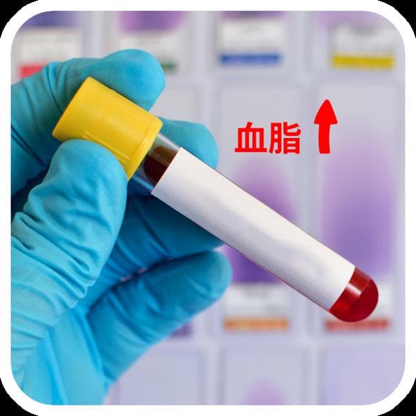 血脂检查是血常规吗