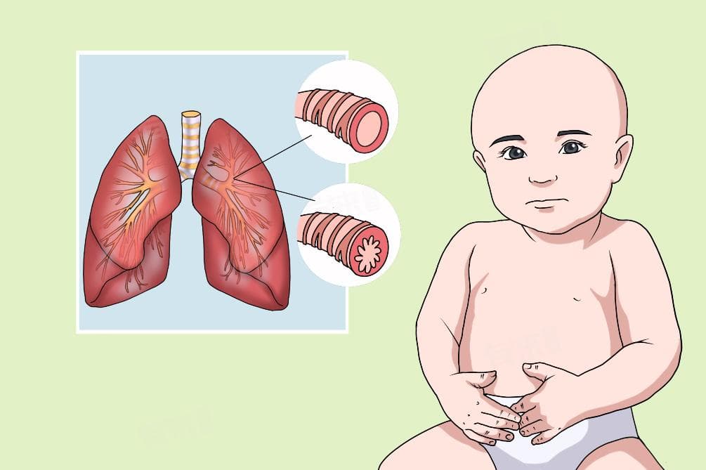 小孩支气管炎晚上咳嗽严重怎么办
