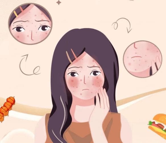皮肤干燥暗黄无光泽怎么办？全方位护肤指南