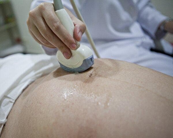 胰腺结节怎么检查出来的