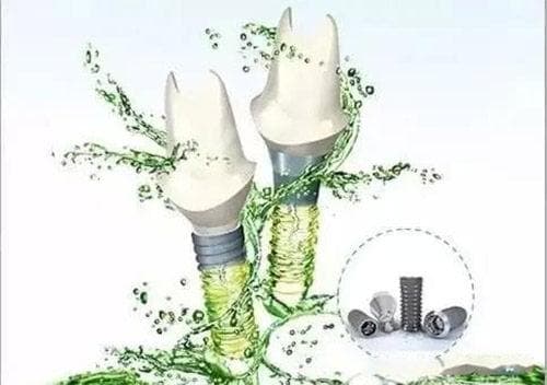 种植牙能用多少年？一般来说适用寿命在10年至40年不等