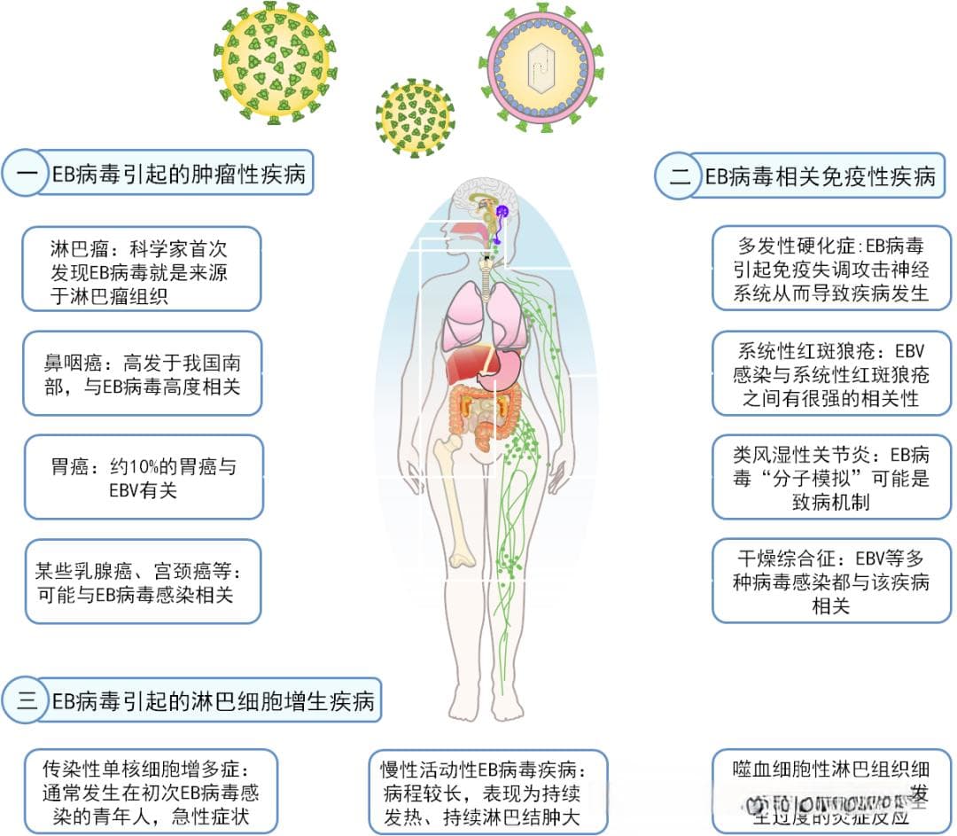 EB病毒感染可以引发哪些疾病