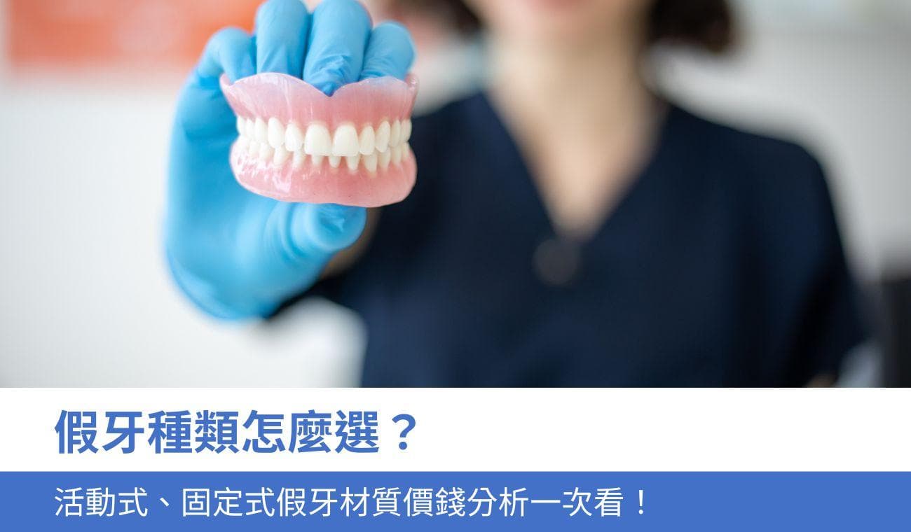 假牙种类：活动式与固定式怎么选？假牙材质价钱分析一次看！