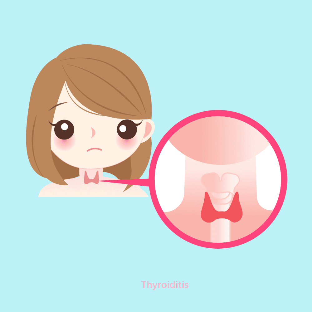 释甲·话蝶 | 产后甲状腺炎（PPT）如何识别和处理？