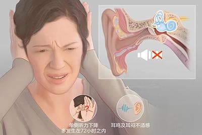 什么是突发性耳聋？症状、诊断、治疗与预防全解析