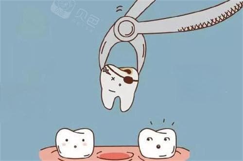 牙拔了可以一直空着吗？医生经验：还是不要了吧