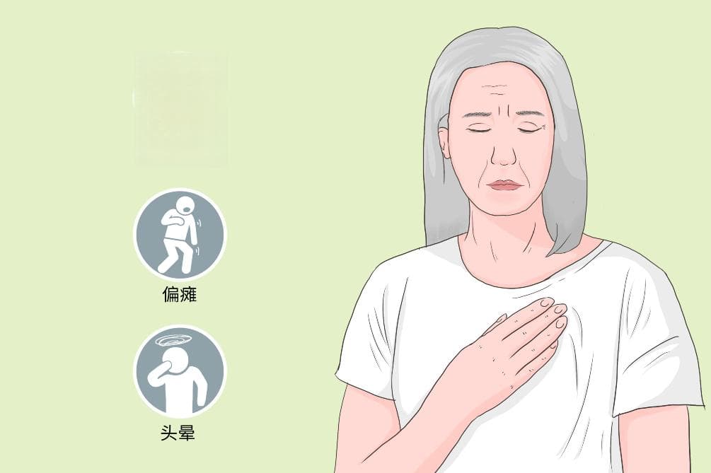 脑心综合征