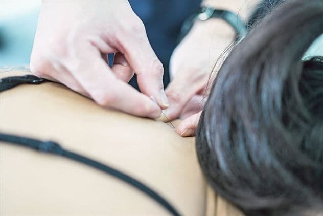 针灸指南：六种主要技术及其功效详解
