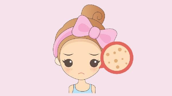 如何预防雀斑？从成因到解决方案的全面指南