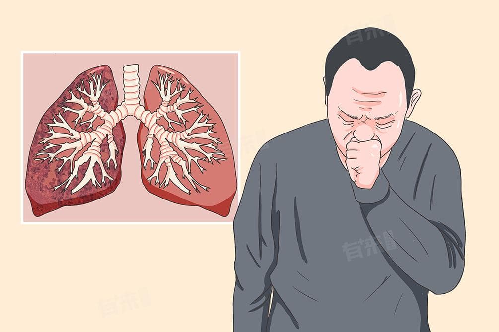 怎样判断口腔有厌氧菌