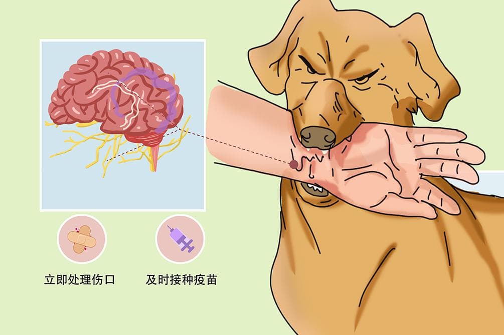狂犬疫苗最佳接种时间：受伤后24小时内最理想