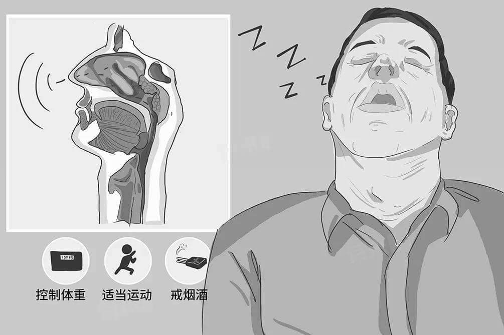 睡觉打呼噜怎么解决