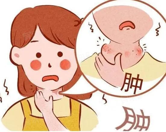 脖子肿了是什么情况