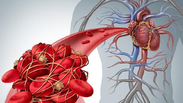 高钙血症怎么处理？四种实用治疗方法全解析