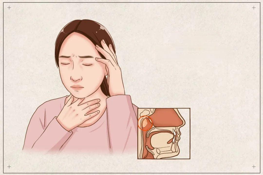 总闻到臭味，你可能被癌症盯上了
