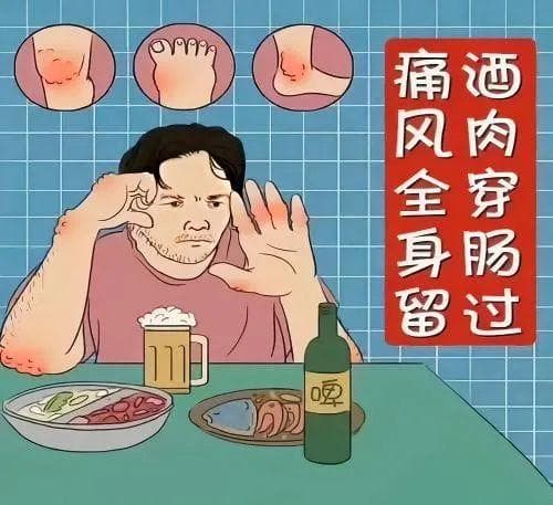 关于“痛风性关节炎”的那些事
