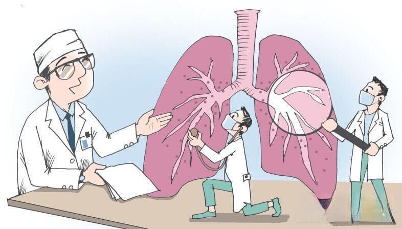 肺癌盯上年轻人，高危人群应每年做这个检查