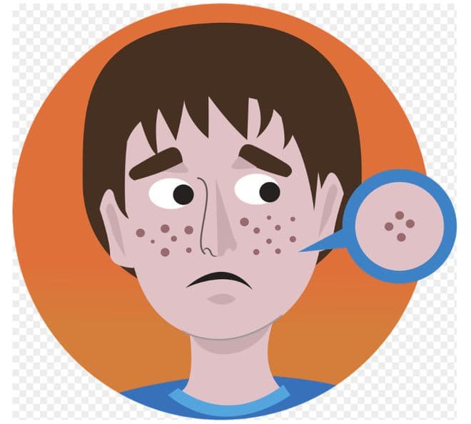 罕见病科普 | 痘痘经久不愈的原因，原来是它……