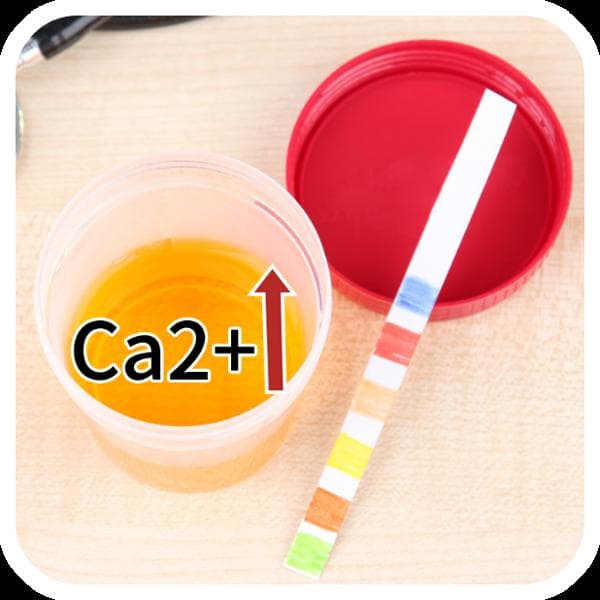 CA125是什么
