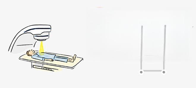 放疗后，我需要与家人隔离吗？