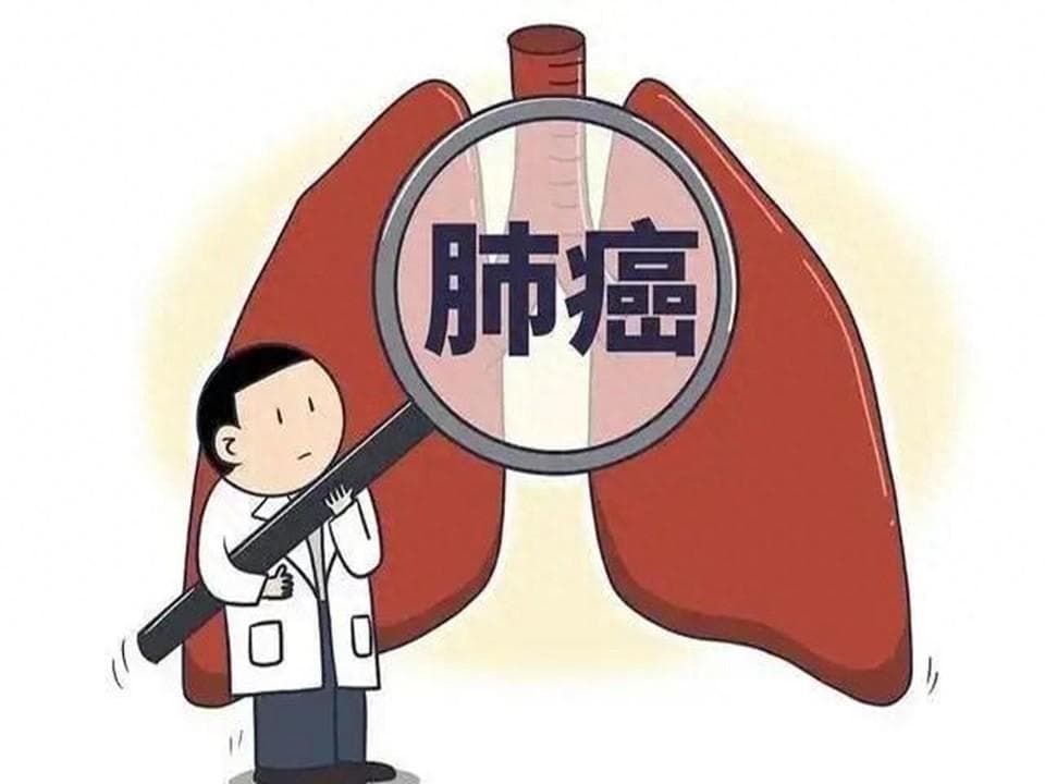 每年肺癌死亡率持续升高，远离5个发病高危因素！出现症状要注意