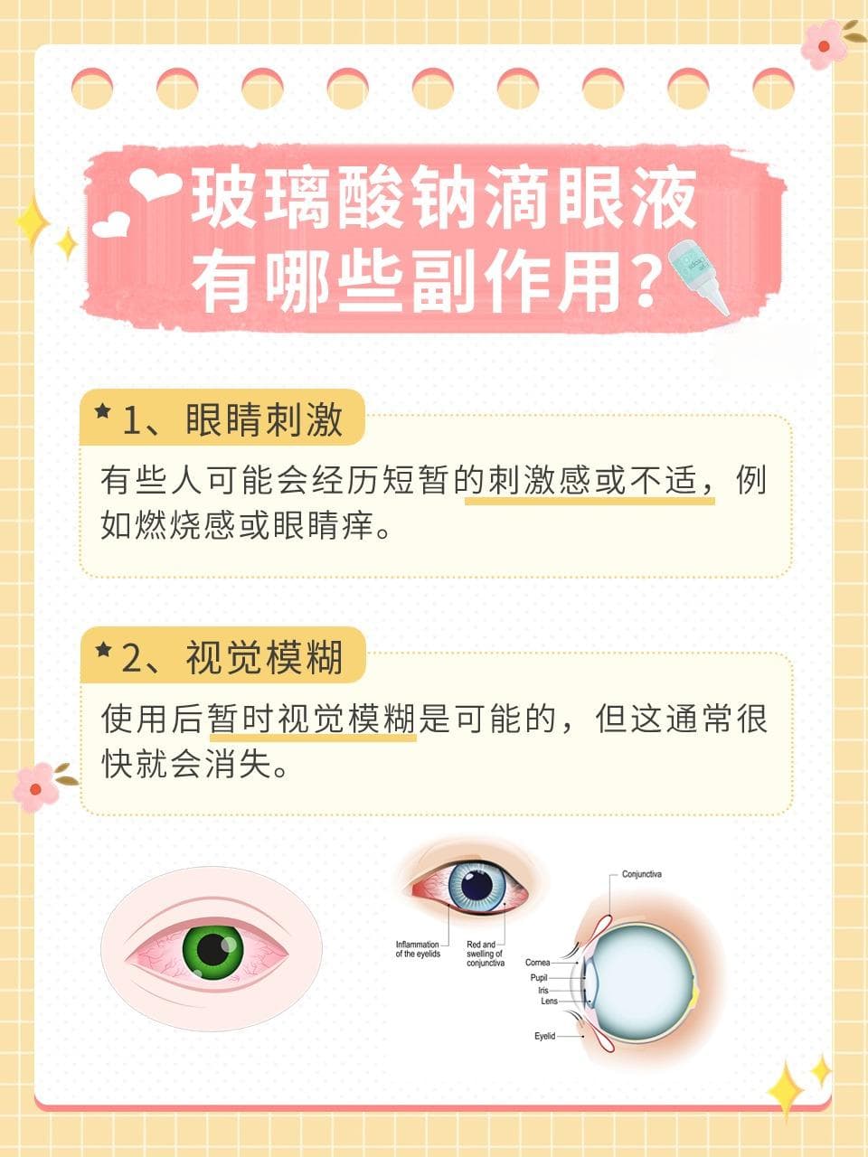 玻璃酸钠滴眼液：缓解眼干的正确使用方法和副作用详解