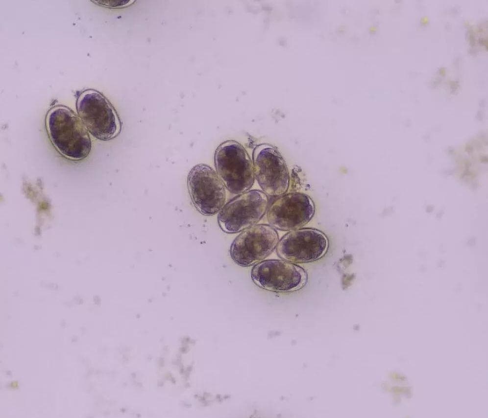 浅谈常见的寄生虫—钩虫